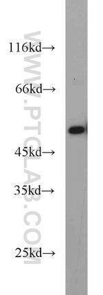 MAGED4 Antibody in Western Blot (WB)