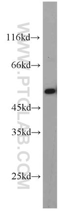 MAGED4 Antibody in Western Blot (WB)