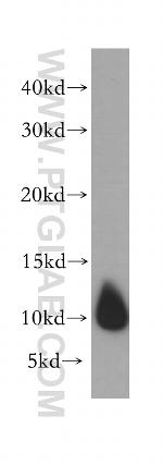 DYNLL2 Antibody in Western Blot (WB)