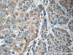 LMF1 Antibody in Immunohistochemistry (Paraffin) (IHC (P))