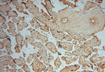 HIP1R Antibody in Immunohistochemistry (Paraffin) (IHC (P))