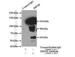 HIP1R Antibody in Immunoprecipitation (IP)