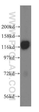 HIP1R Antibody in Western Blot (WB)