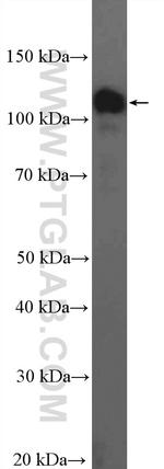 HIP1R Antibody in Western Blot (WB)