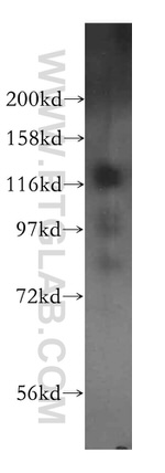 HIP1R Antibody in Western Blot (WB)