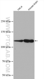 HIP1R Antibody in Western Blot (WB)