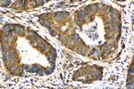 p130Cas Antibody in Immunohistochemistry (Paraffin) (IHC (P))