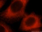 p130Cas Antibody in Immunocytochemistry (ICC/IF)