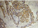 p130Cas Antibody in Immunohistochemistry (Paraffin) (IHC (P))