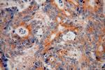 p130Cas Antibody in Immunohistochemistry (Paraffin) (IHC (P))