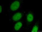 EED Antibody in Immunocytochemistry (ICC/IF)