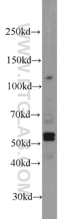 EED Antibody in Western Blot (WB)