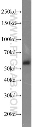 EED Antibody in Western Blot (WB)