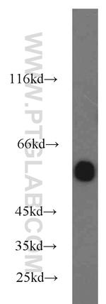 EED Antibody in Western Blot (WB)