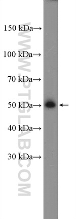 EED Antibody in Western Blot (WB)