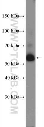 EED Antibody in Western Blot (WB)