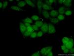 SRF Antibody in Immunocytochemistry (ICC/IF)