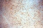 SRF Antibody in Immunohistochemistry (Paraffin) (IHC (P))