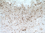 GFAP Antibody in Immunohistochemistry (Paraffin) (IHC (P))