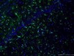 GFAP Antibody in Immunohistochemistry (PFA fixed) (IHC (PFA))