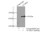 NCAPD3 Antibody in Immunoprecipitation (IP)