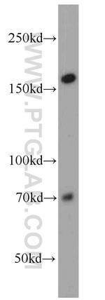 NCAPD3 Antibody in Western Blot (WB)