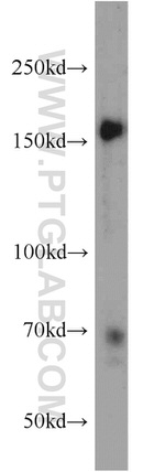 NCAPD3 Antibody in Western Blot (WB)