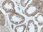 ALKBH5 Antibody in Immunohistochemistry (Paraffin) (IHC (P))