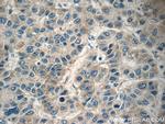 HEBP1 Antibody in Immunohistochemistry (Paraffin) (IHC (P))