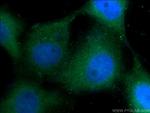 Cytokeratin 1 Antibody in Immunocytochemistry (ICC/IF)