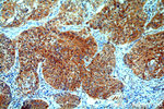 Cytokeratin 1 Antibody in Immunohistochemistry (Paraffin) (IHC (P))