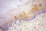 Cytokeratin 1 Antibody in Immunohistochemistry (Paraffin) (IHC (P))