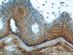 Cytokeratin 1 Antibody in Immunohistochemistry (Paraffin) (IHC (P))