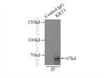 Cytokeratin 1 Antibody in Immunoprecipitation (IP)