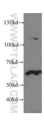 Cytokeratin 1 Antibody in Western Blot (WB)