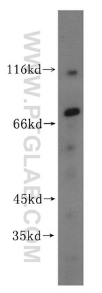 Cytokeratin 1 Antibody in Western Blot (WB)