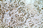 Cytokeratin 10 Antibody in Immunohistochemistry (Paraffin) (IHC (P))