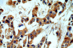 Cytokeratin 10 Antibody in Immunohistochemistry (Paraffin) (IHC (P))