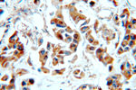 Cytokeratin 10 Antibody in Immunohistochemistry (Paraffin) (IHC (P))