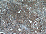 Cytokeratin 10 Antibody in Immunohistochemistry (Paraffin) (IHC (P))