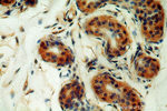 Cytokeratin 10 Antibody in Immunohistochemistry (Paraffin) (IHC (P))