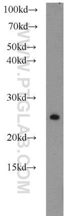 RAB3A Antibody in Western Blot (WB)