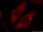 RAB3A Antibody in Immunocytochemistry (ICC/IF)