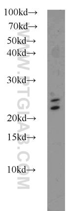 RAB3A Antibody in Western Blot (WB)