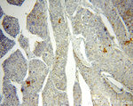 RAB27A Antibody in Immunohistochemistry (Paraffin) (IHC (P))