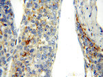 RAB27A Antibody in Immunohistochemistry (Paraffin) (IHC (P))