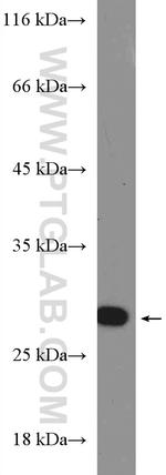 RAB27A Antibody in Western Blot (WB)