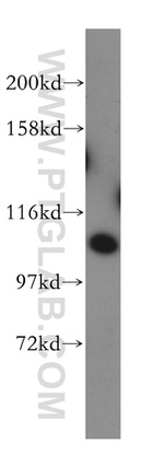 AMOTL1 Antibody in Western Blot (WB)