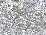 FGF3 Antibody in Immunohistochemistry (Paraffin) (IHC (P))