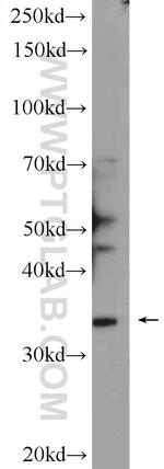 ATAD1 Antibody in Western Blot (WB)